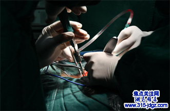 邵阳县人民医院成功完成一例高危高难度颈椎管内肿瘤切除术